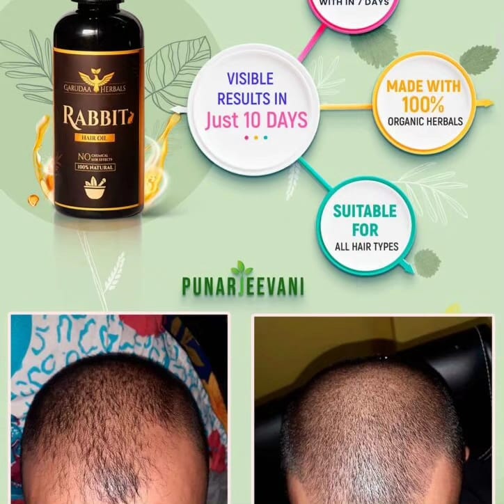 Rabit Herbal Hair Oil - 100% Effective!